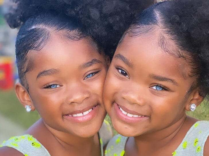 Le gemelle dagli occhi blu stanno guadagnando un enorme seguito su